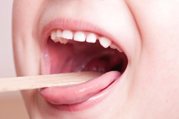 代々木の矯正歯科で口腔筋機能療法（MFT）