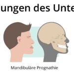 代々木駅前の矯正歯科、代々木クリスタル歯科医院で矯正治療で顎変形症についての解説