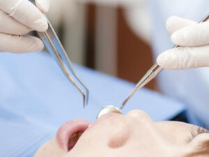 歯ぎしり・食いしばりがある人の矯正治療にはどんなリスクがある？対策を解説