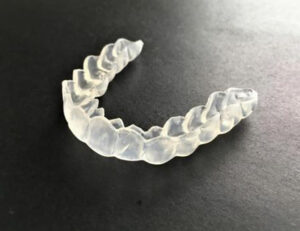 歯ぎしり・食いしばりがある人の矯正治療にはどんなリスクがある？対策を解説