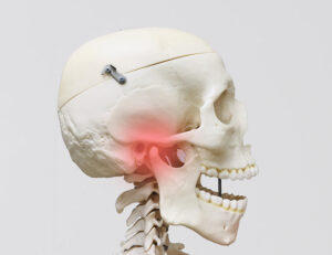 代々木駅前の矯正歯科、代々木クリスタル歯科医院で受け口（反対咬合）が引き起こす健康への影響を解説