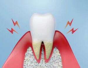 代々木駅前の矯正歯科、代々木クリスタル歯科医院で受け口（反対咬合）が引き起こす健康への影響を解説